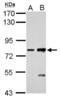 Cadherin 6 antibody, NBP2-17011, Novus Biologicals, Western Blot image 