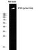 Inositol 1,4,5-Trisphosphate Receptor Type 1 antibody, A01465S1764, Boster Biological Technology, Western Blot image 