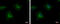 Protein Tyrosine Kinase 7 (Inactive) antibody, GTX113816, GeneTex, Immunocytochemistry image 