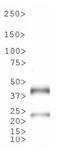 Tet Repressor antibody, NB600-234, Novus Biologicals, Western Blot image 