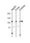 Microsomal Triglyceride Transfer Protein antibody, PA5-49412, Invitrogen Antibodies, Western Blot image 
