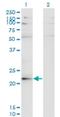 Ladybird Homeobox 2 antibody, H00085474-M02, Novus Biologicals, Western Blot image 