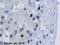 Small Nuclear Ribonucleoprotein U1 Subunit 70 antibody, ab51266, Abcam, Immunohistochemistry paraffin image 