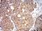 Superoxide Dismutase 2 antibody, NBP2-61885, Novus Biologicals, Immunohistochemistry paraffin image 