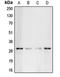 Complement C1q Binding Protein antibody, orb213622, Biorbyt, Western Blot image 