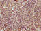 Transmembrane Protein 14A antibody, LS-C376812, Lifespan Biosciences, Immunohistochemistry paraffin image 