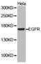 Atonal BHLH Transcription Factor 1 antibody, LS-C192614, Lifespan Biosciences, Western Blot image 