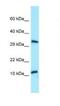 Testis-specific basic protein Y 2 antibody, NBP1-98290, Novus Biologicals, Western Blot image 