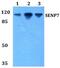 SUMO Specific Peptidase 7 antibody, PA5-36089, Invitrogen Antibodies, Western Blot image 