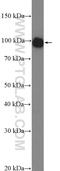 Glycogen Phosphorylase, Muscle Associated antibody, 19716-1-AP, Proteintech Group, Western Blot image 