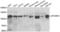 GTF2I Repeat Domain Containing 1 antibody, LS-C334833, Lifespan Biosciences, Western Blot image 