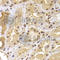 PHD Finger Protein 21B antibody, A7849, ABclonal Technology, Immunohistochemistry paraffin image 