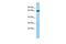 Acyl-CoA Oxidase Like antibody, GTX16559, GeneTex, Western Blot image 