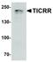 TOPBP1 Interacting Checkpoint And Replication Regulator antibody, LS-B12147, Lifespan Biosciences, Western Blot image 