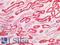 Keratin 8 antibody, LS-B16514, Lifespan Biosciences, Immunohistochemistry paraffin image 