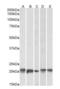 Ferritin Light Chain antibody, orb20089, Biorbyt, Western Blot image 