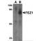 Fasciculation And Elongation Protein Zeta 1 antibody, MBS150572, MyBioSource, Western Blot image 