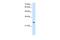 Phosphopantothenoylcysteine Decarboxylase antibody, PA5-42852, Invitrogen Antibodies, Western Blot image 