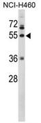 Fibrinogen Gamma Chain antibody, AP17375PU-N, Origene, Western Blot image 