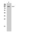 EPH Receptor A3 antibody, STJ92942, St John