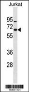 Zinc Finger Protein 358 antibody, 60-575, ProSci, Western Blot image 