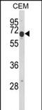 EDIL3 antibody, PA5-72611, Invitrogen Antibodies, Western Blot image 