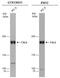 TSC Complex Subunit 2 antibody, GTX130511, GeneTex, Western Blot image 