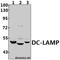 Lysosomal Associated Membrane Protein 3 antibody, A09406-1, Boster Biological Technology, Western Blot image 