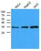 Carbonyl Reductase 1 antibody, GTX53696, GeneTex, Western Blot image 