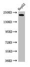 Retinoic Acid Induced 1 antibody, CSB-PA768772LA01HU, Cusabio, Western Blot image 