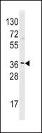 Histamine N-Methyltransferase antibody, 57-727, ProSci, Western Blot image 