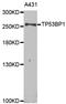 Tumor Protein P53 Binding Protein 1 antibody, A5757, ABclonal Technology, Western Blot image 
