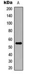 Aldehyde Dehydrogenase 1 Family Member A2 antibody, MBS8219483, MyBioSource, Western Blot image 
