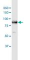 Doublecortin Like Kinase 1 antibody, H00009201-M03, Novus Biologicals, Western Blot image 