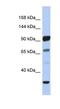 Protocadherin Alpha 10 antibody, NBP1-59258, Novus Biologicals, Western Blot image 