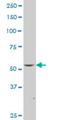 FLI1 antibody, H00002313-M07, Novus Biologicals, Western Blot image 