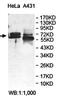 Growth Factor Receptor Bound Protein 7 antibody, orb78275, Biorbyt, Western Blot image 