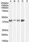 Asporin antibody, GTX89589, GeneTex, Western Blot image 