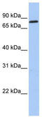 Zinc Finger Protein 226 antibody, TA339652, Origene, Western Blot image 