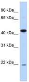 NIN1 (RPN12) Binding Protein 1 Homolog antibody, TA334493, Origene, Western Blot image 