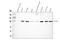 Actinin Alpha 4 antibody, PB9974, Boster Biological Technology, Western Blot image 