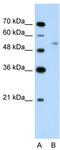 Ubiquitin Protein Ligase E3 Component N-Recognin 7 (Putative) antibody, TA329874, Origene, Western Blot image 