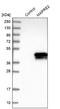 Microtubule Associated Protein RP/EB Family Member 2 antibody, NBP1-84927, Novus Biologicals, Western Blot image 