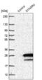 Synaptogyrin 4 antibody, NBP1-87530, Novus Biologicals, Western Blot image 