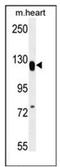 Mediator Complex Subunit 14 antibody, AP52649PU-N, Origene, Western Blot image 