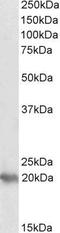 P53 Apoptosis Effector Related To PMP22 antibody, GTX89344, GeneTex, Western Blot image 