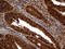 MutS Homolog 6 antibody, LS-C799618, Lifespan Biosciences, Immunohistochemistry paraffin image 