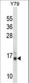 Profilin 2 antibody, LS-C163537, Lifespan Biosciences, Western Blot image 