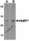 Vesicle Associated Membrane Protein 7 antibody, 6929, ProSci, Western Blot image 