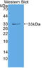 Serine/threonine-protein kinase D1 antibody, LS-C314527, Lifespan Biosciences, Western Blot image 